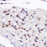 Immunohistochemistry - Anti-CUG-BP1 Antibody (A11903) - Antibodies.com