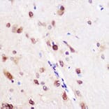 Immunohistochemistry - Anti-CUG-BP1 Antibody (A11903) - Antibodies.com