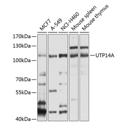 Western Blot - Anti-UTP14A Antibody (A11904) - Antibodies.com