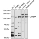 Western Blot - Anti-UTP14A Antibody (A11904) - Antibodies.com