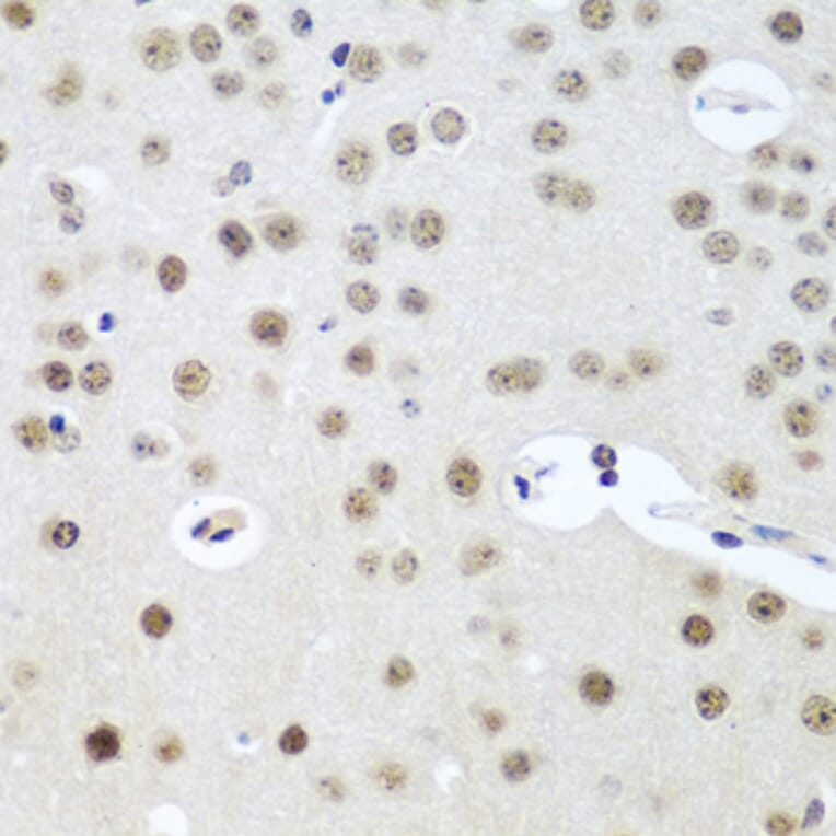 Immunohistochemistry - Anti-UTP14A Antibody (A11904) - Antibodies.com