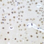 Immunohistochemistry - Anti-UTP14A Antibody (A11904) - Antibodies.com