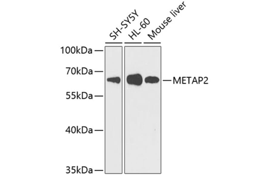 Western Blot - Anti-Methionine Aminopeptidase 2/p67 Antibody (A11905) - Antibodies.com