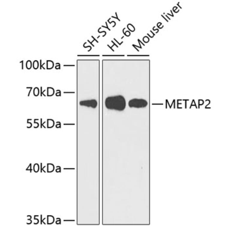 Western Blot - Anti-Methionine Aminopeptidase 2/p67 Antibody (A11905) - Antibodies.com