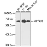 Western Blot - Anti-Methionine Aminopeptidase 2/p67 Antibody (A11905) - Antibodies.com