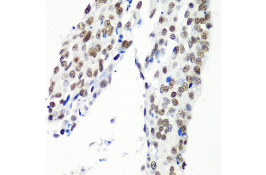Immunohistochemistry - Anti-HTATSF1 Antibody (A11906) - Antibodies.com