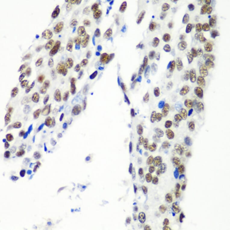 Immunohistochemistry - Anti-HTATSF1 Antibody (A11906) - Antibodies.com