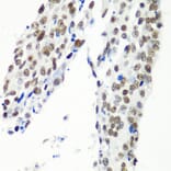 Immunohistochemistry - Anti-HTATSF1 Antibody (A11906) - Antibodies.com