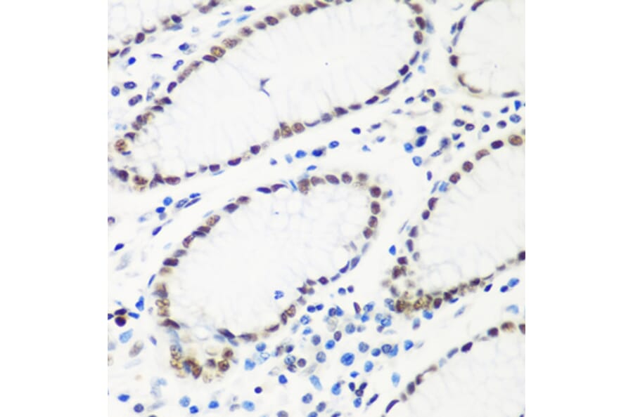 Immunohistochemistry - Anti-HTATSF1 Antibody (A11906) - Antibodies.com
