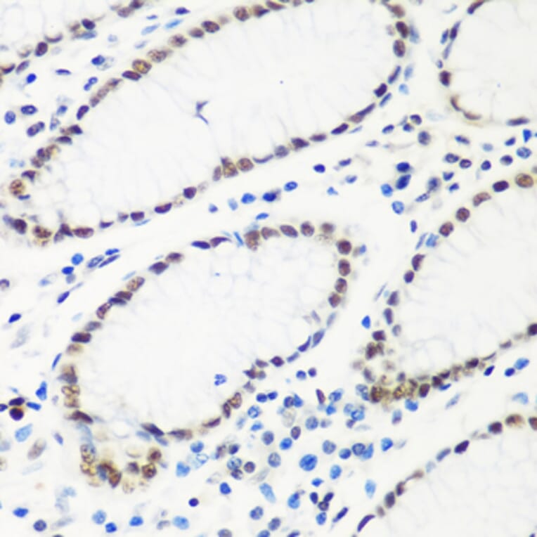Immunohistochemistry - Anti-HTATSF1 Antibody (A11906) - Antibodies.com