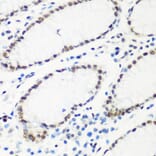 Immunohistochemistry - Anti-HTATSF1 Antibody (A11906) - Antibodies.com