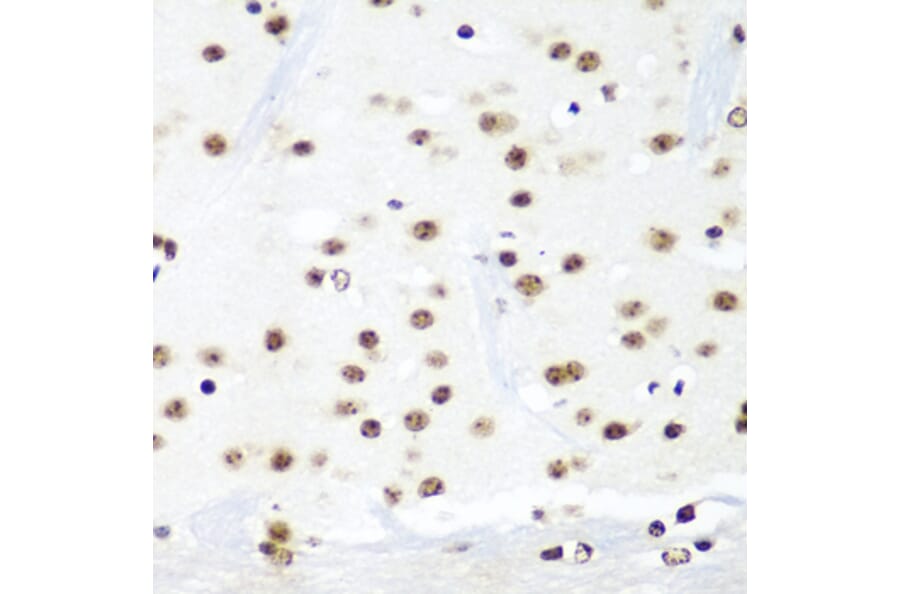 Immunohistochemistry - Anti-HTATSF1 Antibody (A11906) - Antibodies.com