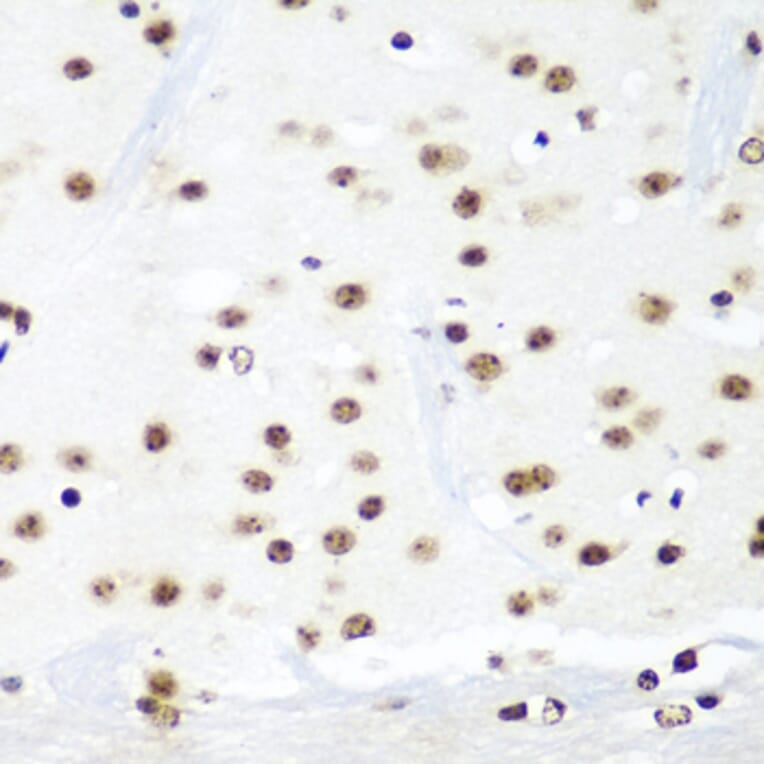 Immunohistochemistry - Anti-HTATSF1 Antibody (A11906) - Antibodies.com