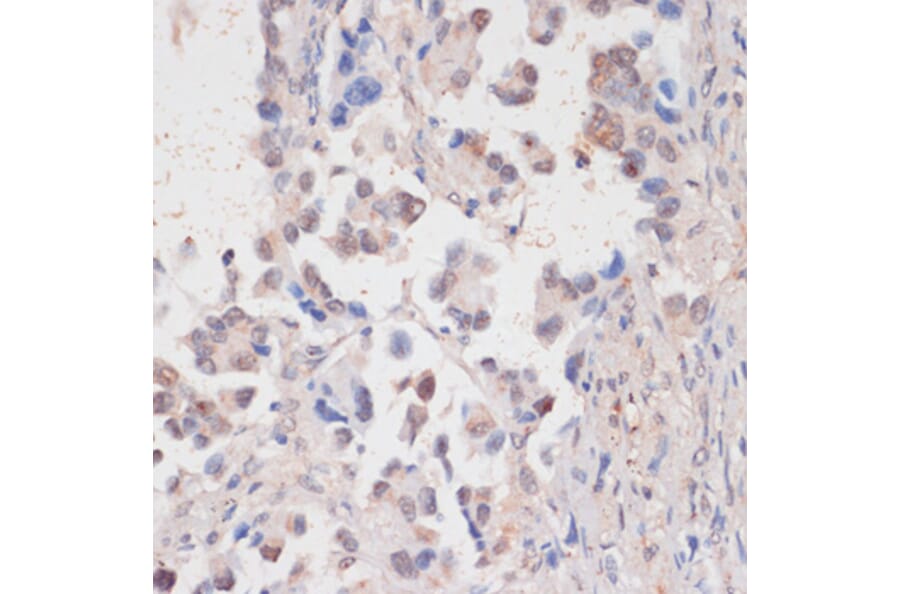 Immunohistochemistry - Anti-HTATSF1 Antibody (A11906) - Antibodies.com