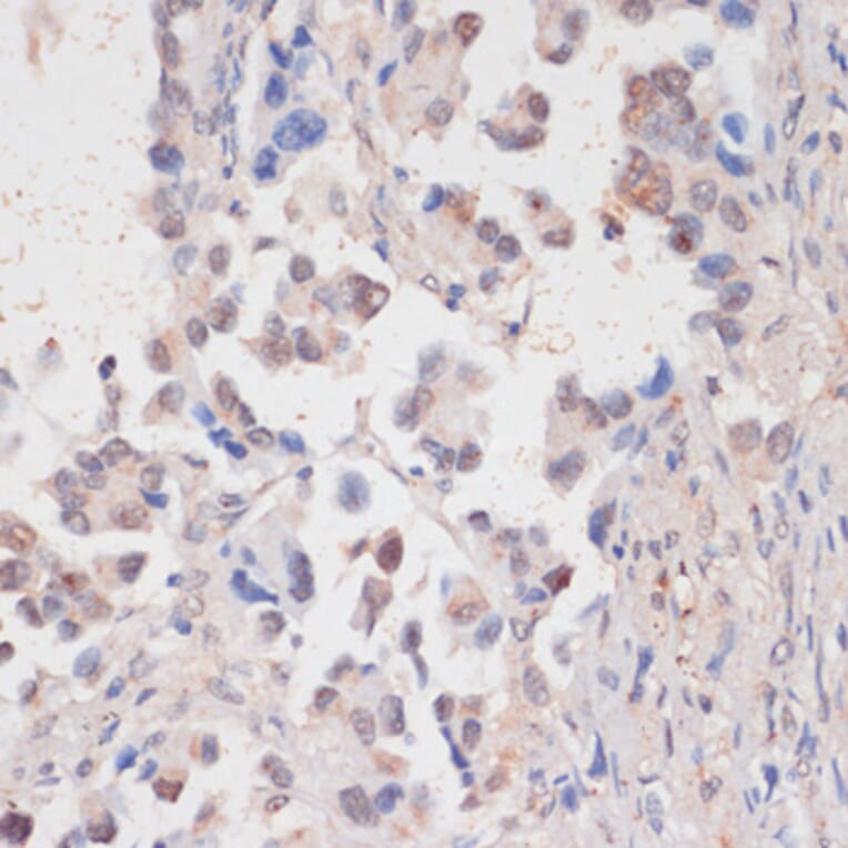 Immunohistochemistry - Anti-HTATSF1 Antibody (A11906) - Antibodies.com