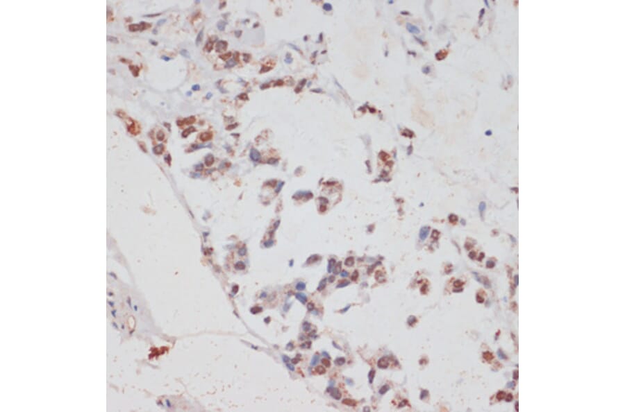 Immunohistochemistry - Anti-HTATSF1 Antibody (A11906) - Antibodies.com