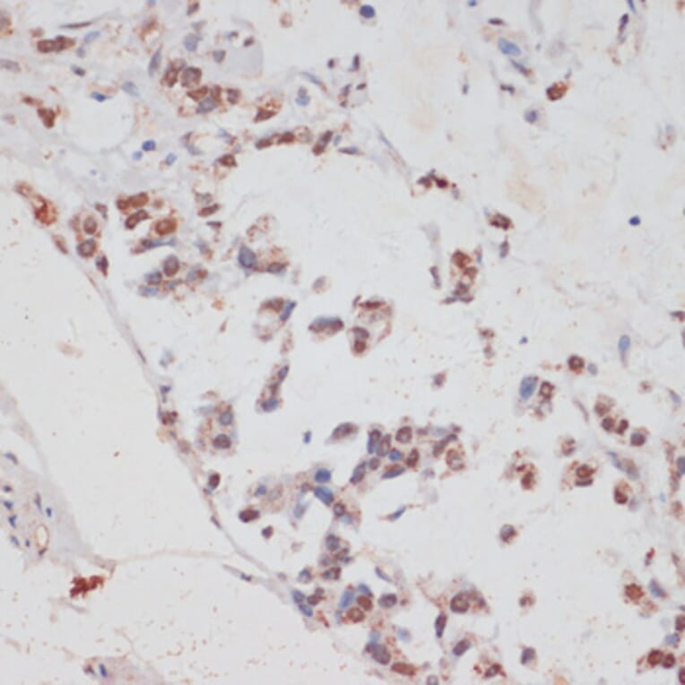 Immunohistochemistry - Anti-HTATSF1 Antibody (A11906) - Antibodies.com
