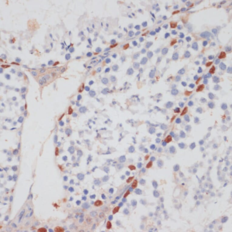 Immunohistochemistry - Anti-HTATSF1 Antibody (A11906) - Antibodies.com
