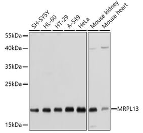 Western Blot - Anti-MRPL13 Antibody (A11907) - Antibodies.com