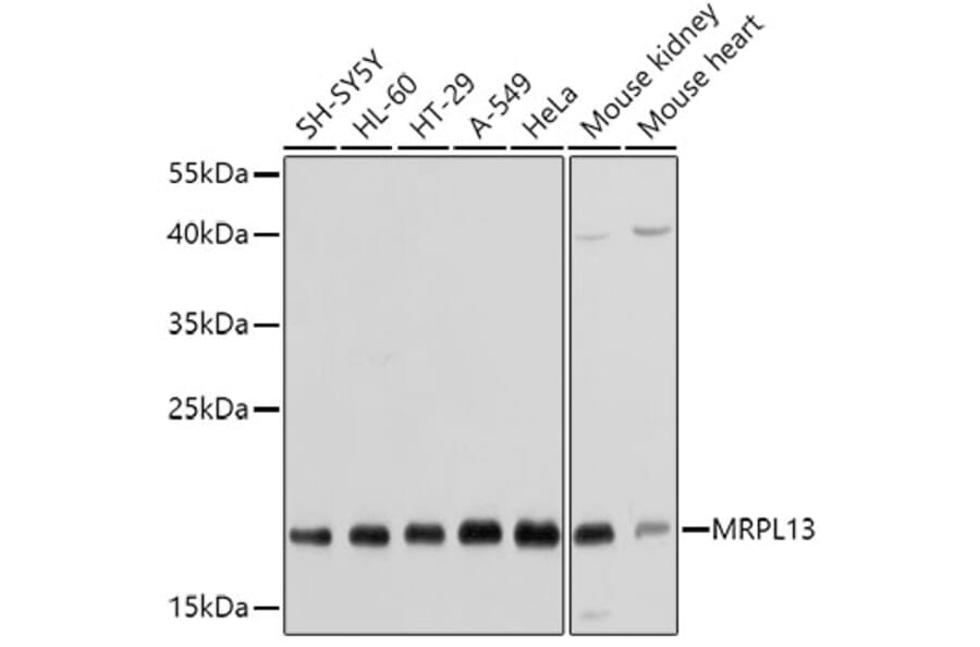 Western Blot - Anti-MRPL13 Antibody (A11907) - Antibodies.com