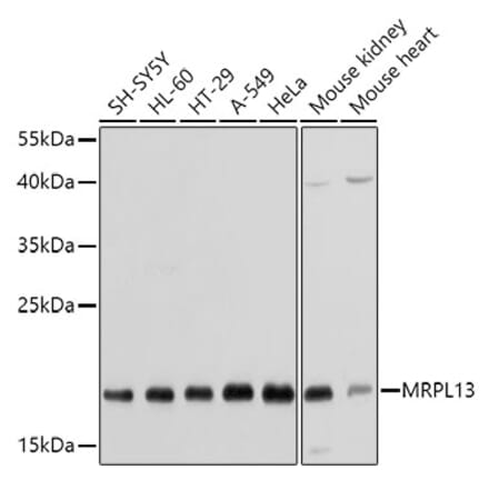 Western Blot - Anti-MRPL13 Antibody (A11907) - Antibodies.com