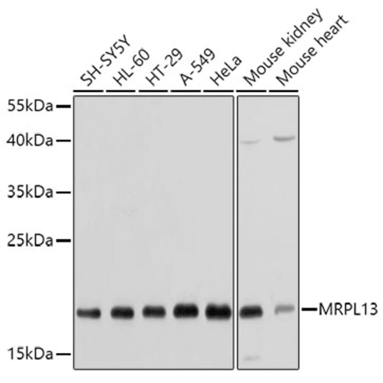 Western Blot - Anti-MRPL13 Antibody (A11907) - Antibodies.com