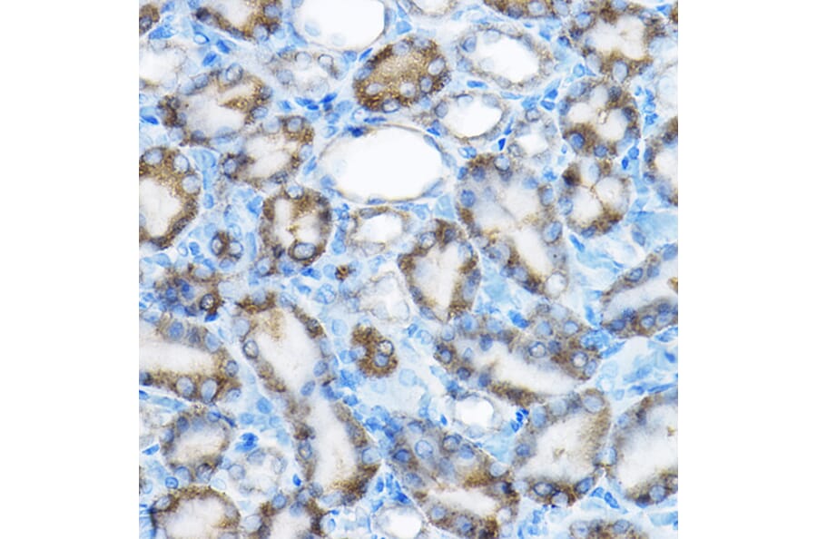 Immunohistochemistry - Anti-MRPL13 Antibody (A11907) - Antibodies.com