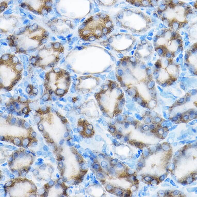 Immunohistochemistry - Anti-MRPL13 Antibody (A11907) - Antibodies.com