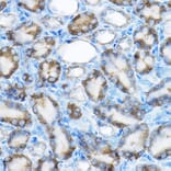 Immunohistochemistry - Anti-MRPL13 Antibody (A11907) - Antibodies.com