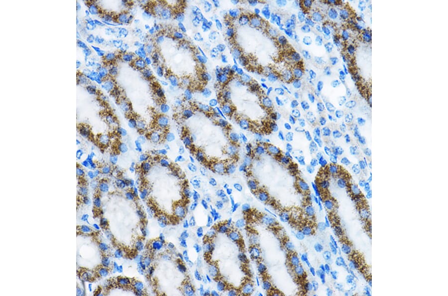 Immunohistochemistry - Anti-MRPL13 Antibody (A11907) - Antibodies.com
