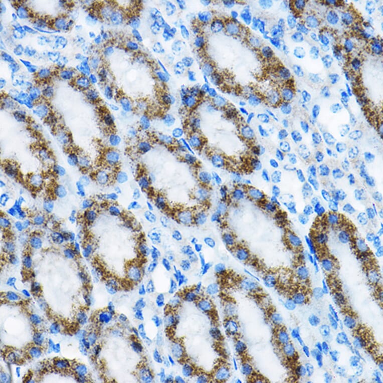 Immunohistochemistry - Anti-MRPL13 Antibody (A11907) - Antibodies.com