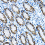 Immunohistochemistry - Anti-MRPL13 Antibody (A11907) - Antibodies.com