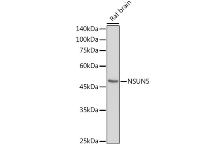 Western Blot - Anti-NSUN5 Antibody (A11908) - Antibodies.com
