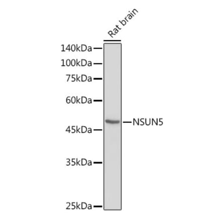 Western Blot - Anti-NSUN5 Antibody (A11908) - Antibodies.com