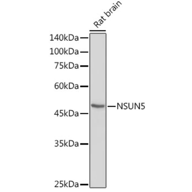 Western Blot - Anti-NSUN5 Antibody (A11908) - Antibodies.com