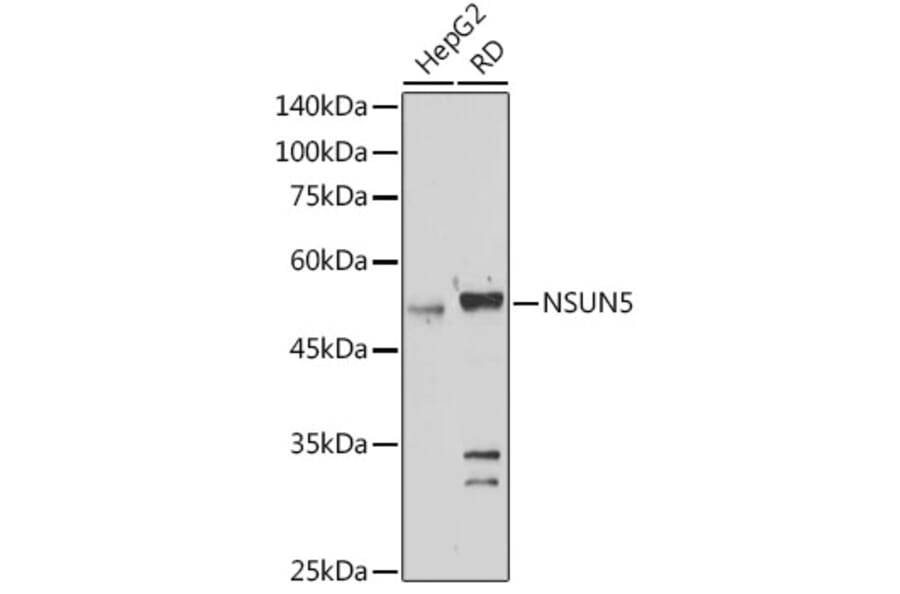 Western Blot - Anti-NSUN5 Antibody (A11908) - Antibodies.com