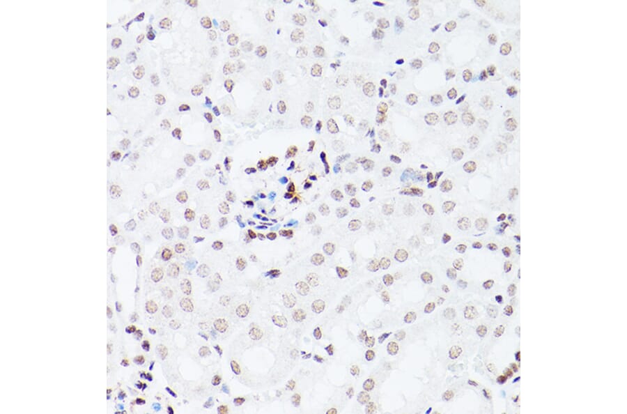 Immunohistochemistry - Anti-NSUN5 Antibody (A11908) - Antibodies.com