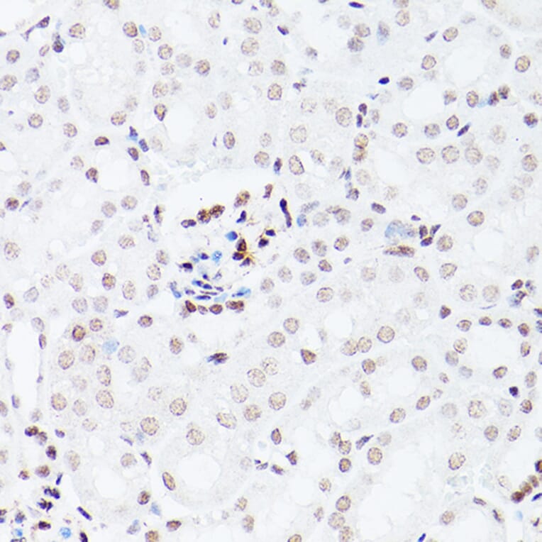 Immunohistochemistry - Anti-NSUN5 Antibody (A11908) - Antibodies.com
