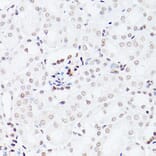 Immunohistochemistry - Anti-NSUN5 Antibody (A11908) - Antibodies.com