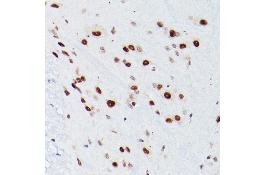 Immunohistochemistry - Anti-NSUN5 Antibody (A11908) - Antibodies.com