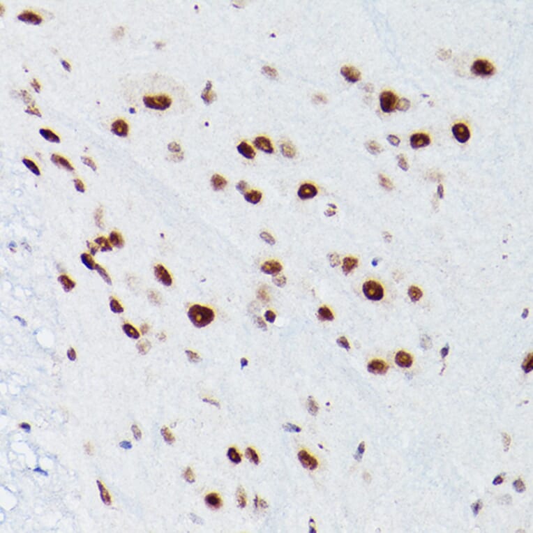 Immunohistochemistry - Anti-NSUN5 Antibody (A11908) - Antibodies.com