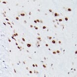 Immunohistochemistry - Anti-NSUN5 Antibody (A11908) - Antibodies.com