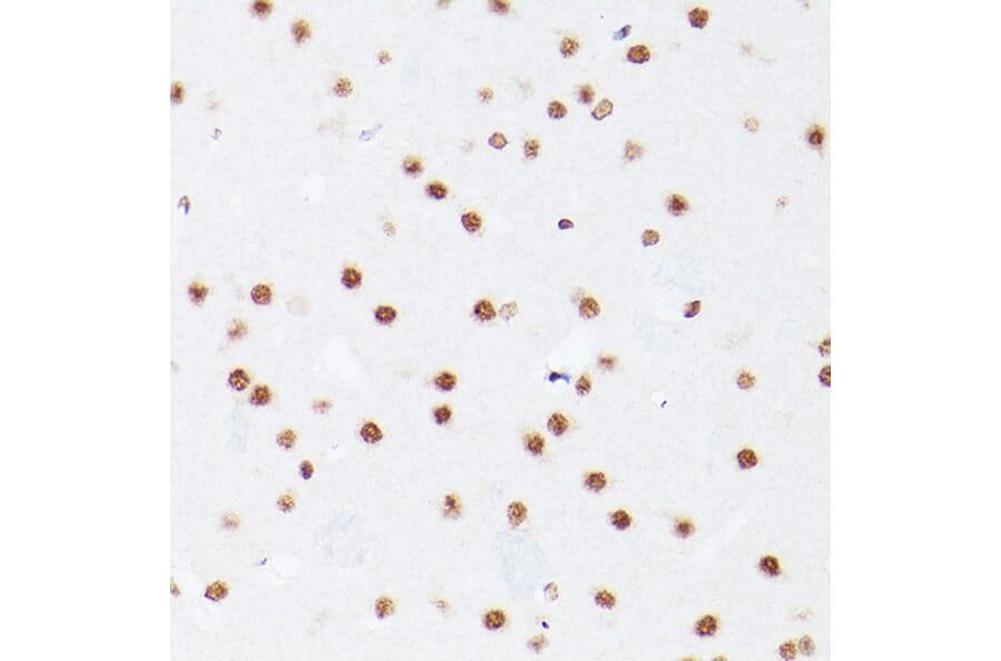 Immunohistochemistry - Anti-NSUN5 Antibody (A11908) - Antibodies.com