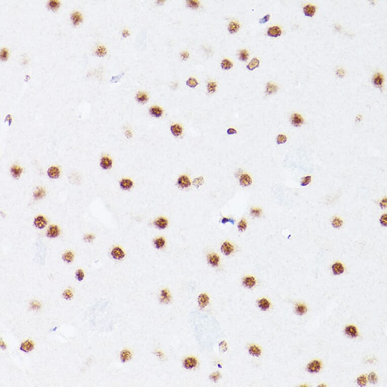Immunohistochemistry - Anti-NSUN5 Antibody (A11908) - Antibodies.com