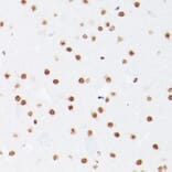 Immunohistochemistry - Anti-NSUN5 Antibody (A11908) - Antibodies.com