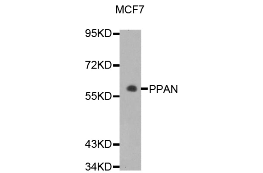 Western Blot - Anti-PPAN Antibody (A5994) - Antibodies.com