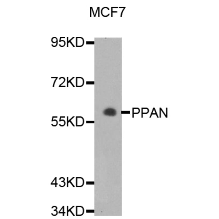 Western Blot - Anti-PPAN Antibody (A5994) - Antibodies.com