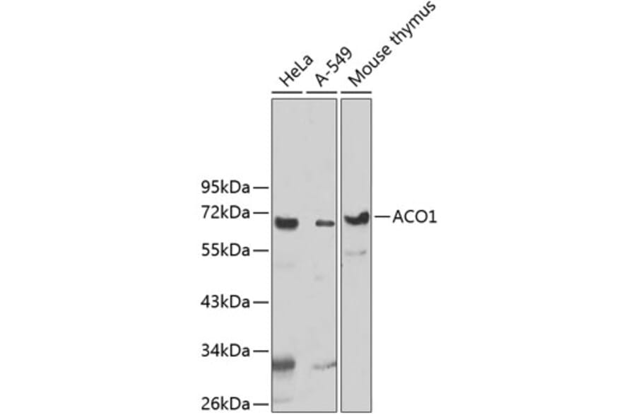 Western Blot - Anti-UTP3 Antibody (A5995) - Antibodies.com