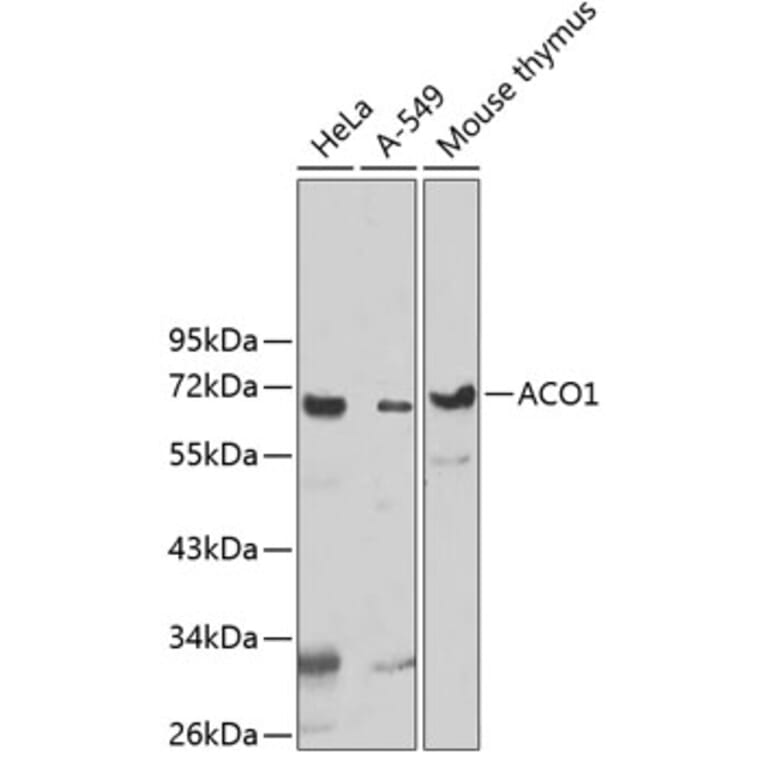 Western Blot - Anti-UTP3 Antibody (A5995) - Antibodies.com