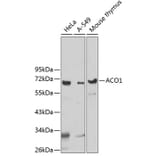 Western Blot - Anti-UTP3 Antibody (A5995) - Antibodies.com